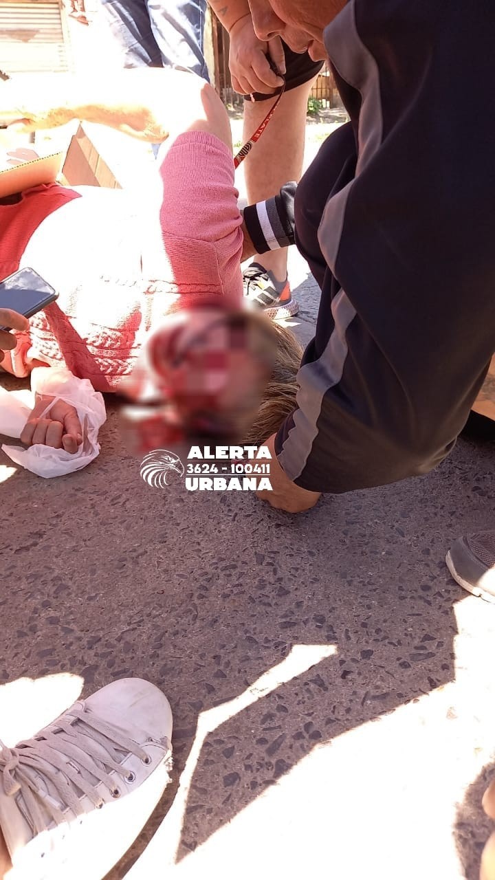 Una mujer de 79 años fue atropellada por una motociclista en Av. Urquiza