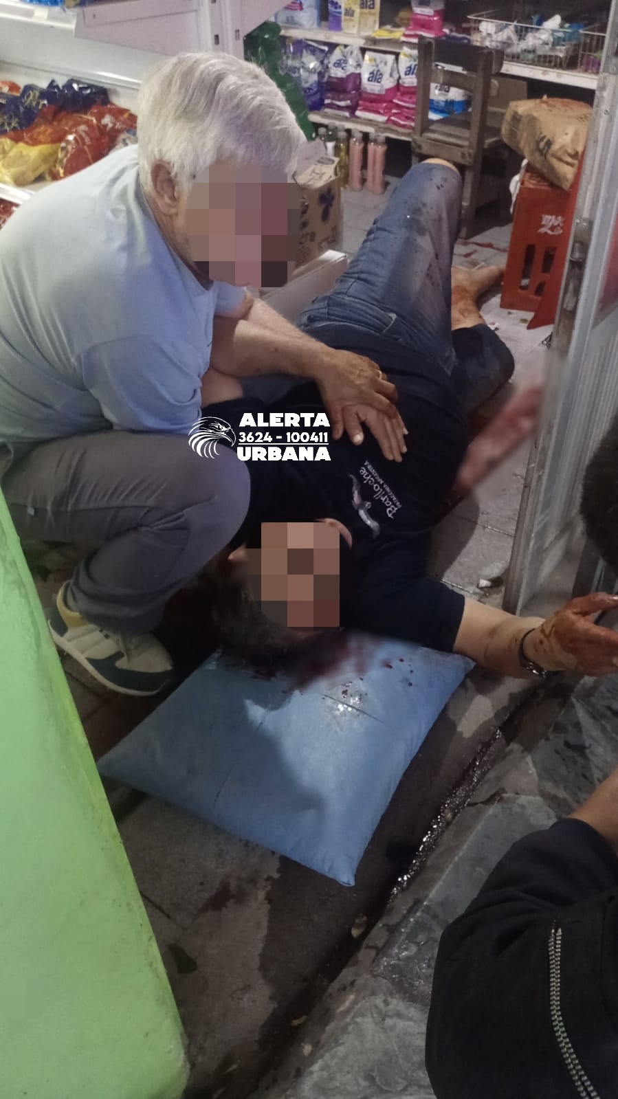 Le disparó en la pierna para robarle una cadena de oro  