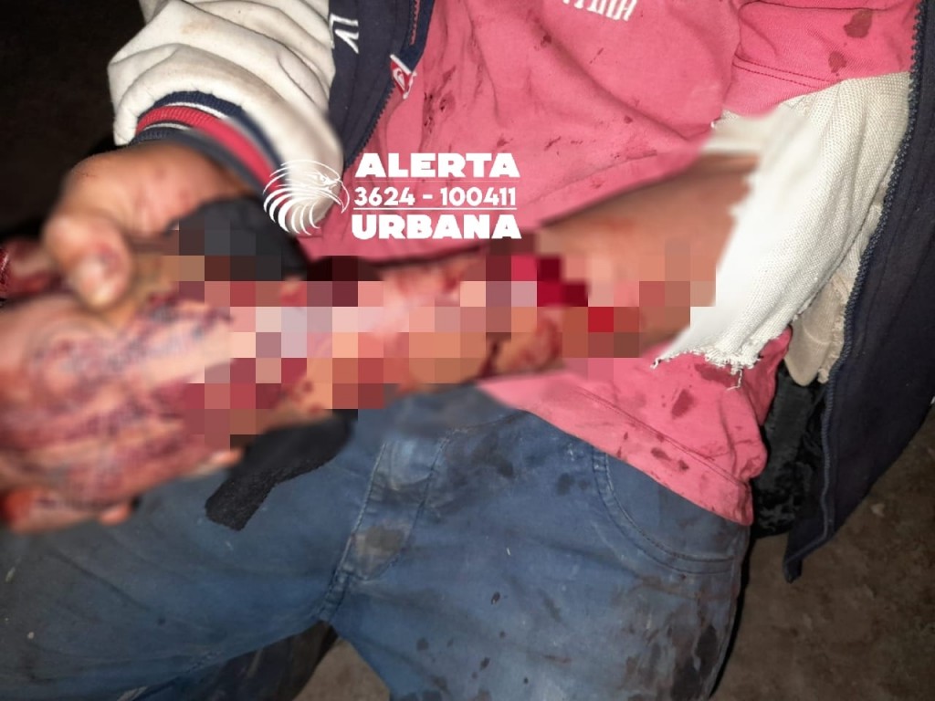 Aprehendieron a un hombre por herir a otro con un machete