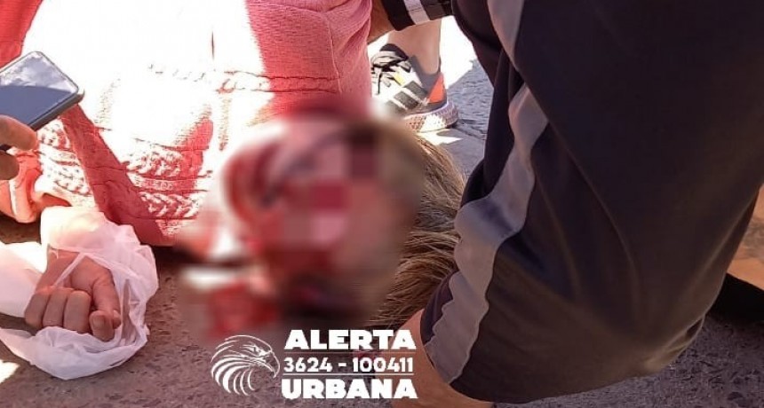 Una mujer de 79 años fue atropellada por una motociclista en Av. Urquiza