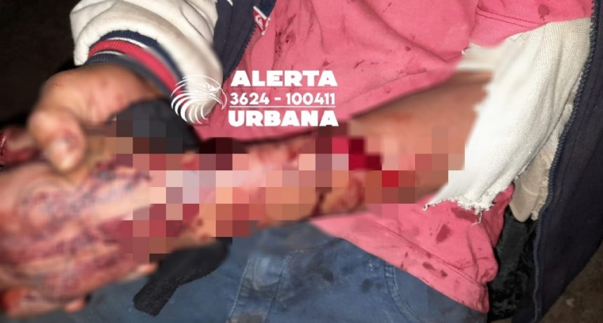 Aprehendieron a un hombre por herir a otro con un machete